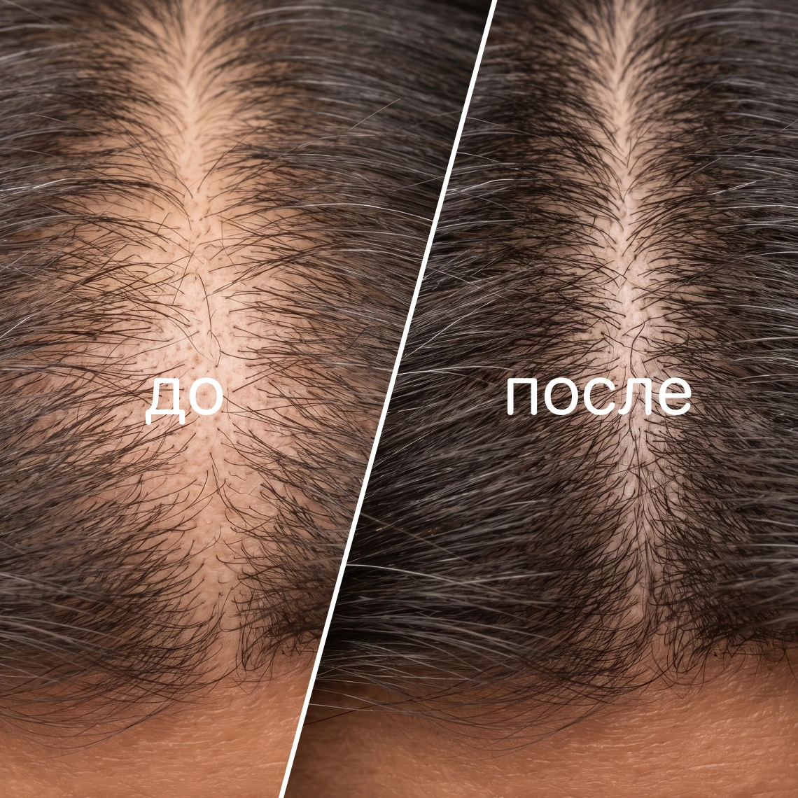 Hair Booster